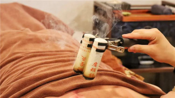 热敏灸疗法功效包括温经散寒,行气通络;扶阳固脱